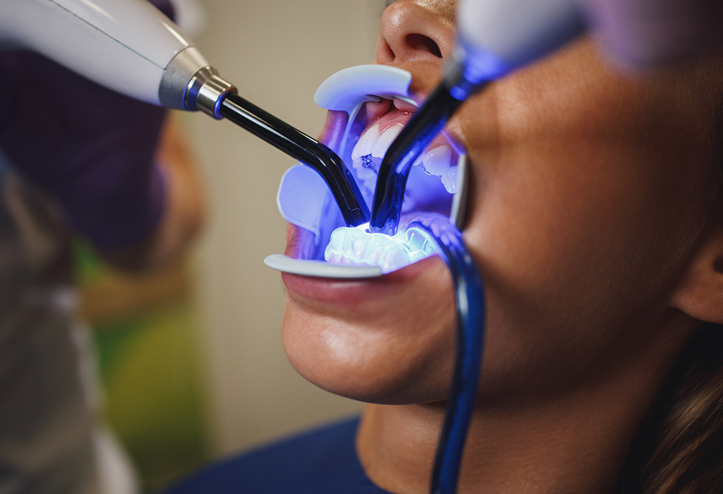 sistemas de aparición dental